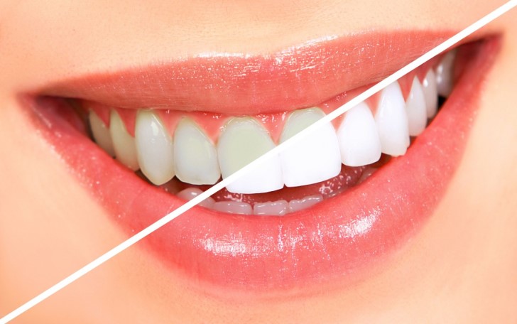 white teeth with coconut oil