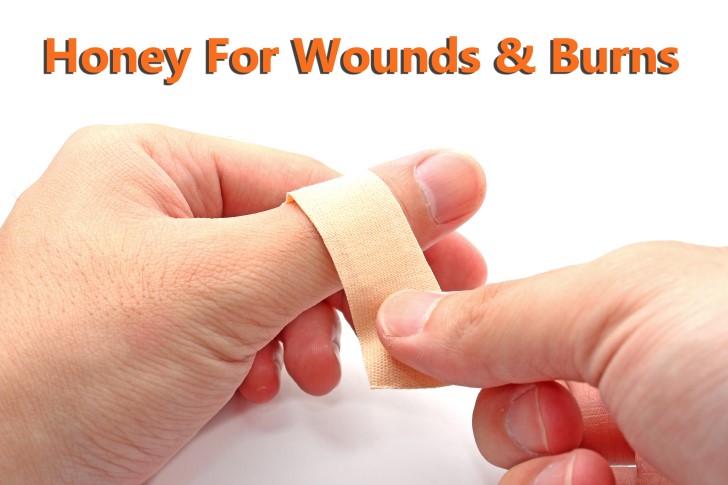 honey for wounds and burns